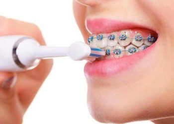 Best Electric Toothbrush For Braces